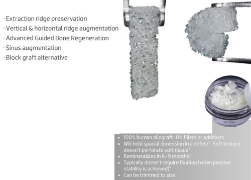 Bone Allograft Sponges