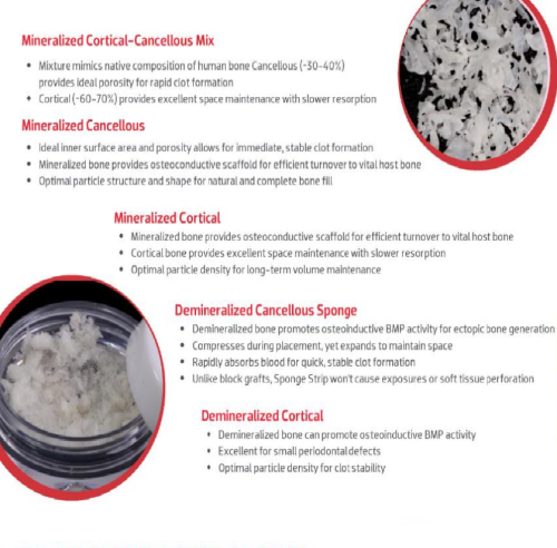 Bone Allograft Particulates