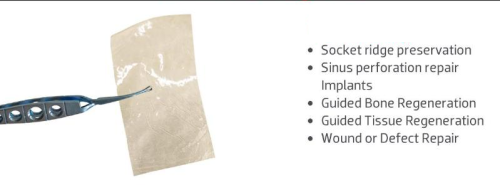 Amnion Chorion-Chorion Sheet